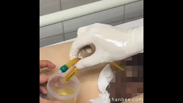 医学临床男女导尿管安插教程-0008