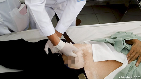 医生导师让女学员体验临床检查男性腹股疝-0017