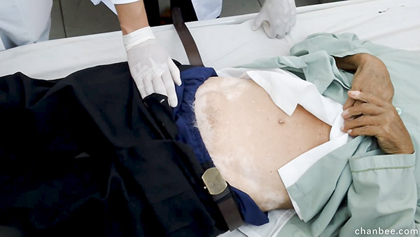 医生导师让女学员体验临床检查男性腹股疝-0013
