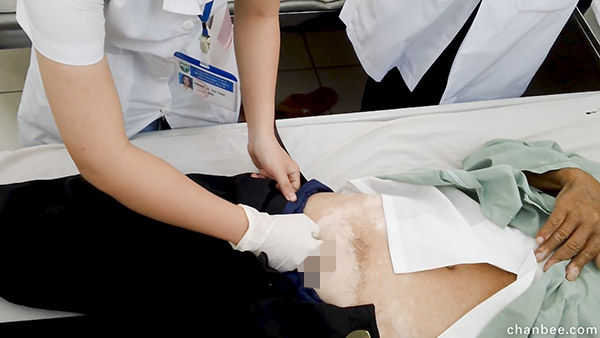 医生导师让女学员体验临床检查男性腹股疝-0019