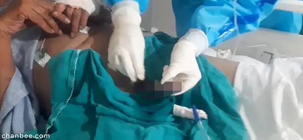 护士给老伯更换尿套为导尿管-0003