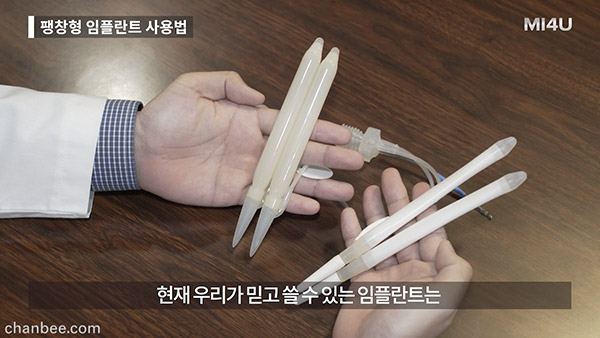 韩国中老年假体植入助勃器测试