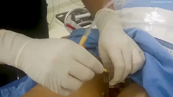 外科医生给手术前男性患者插导尿管-0005