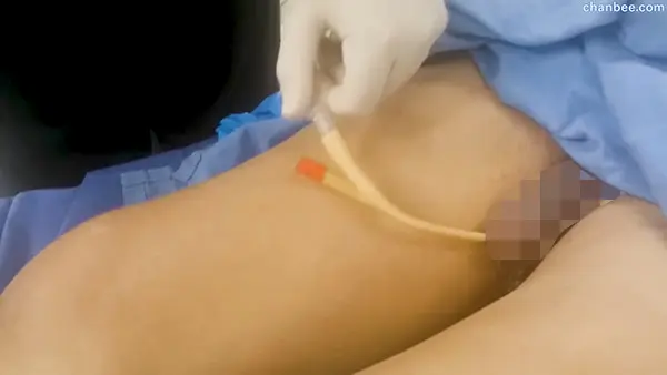 外科医生给手术前男性患者插导尿管-0007