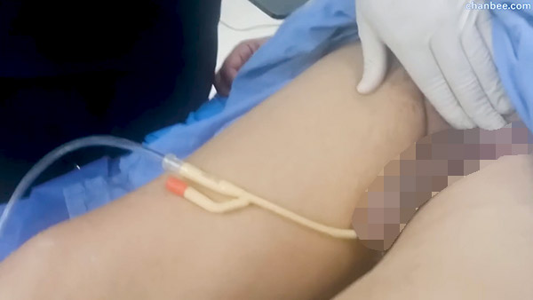 外科医生给手术前男性患者插导尿管-0009