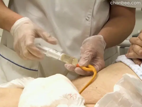 护士给白发老伯更换导尿管-0006
