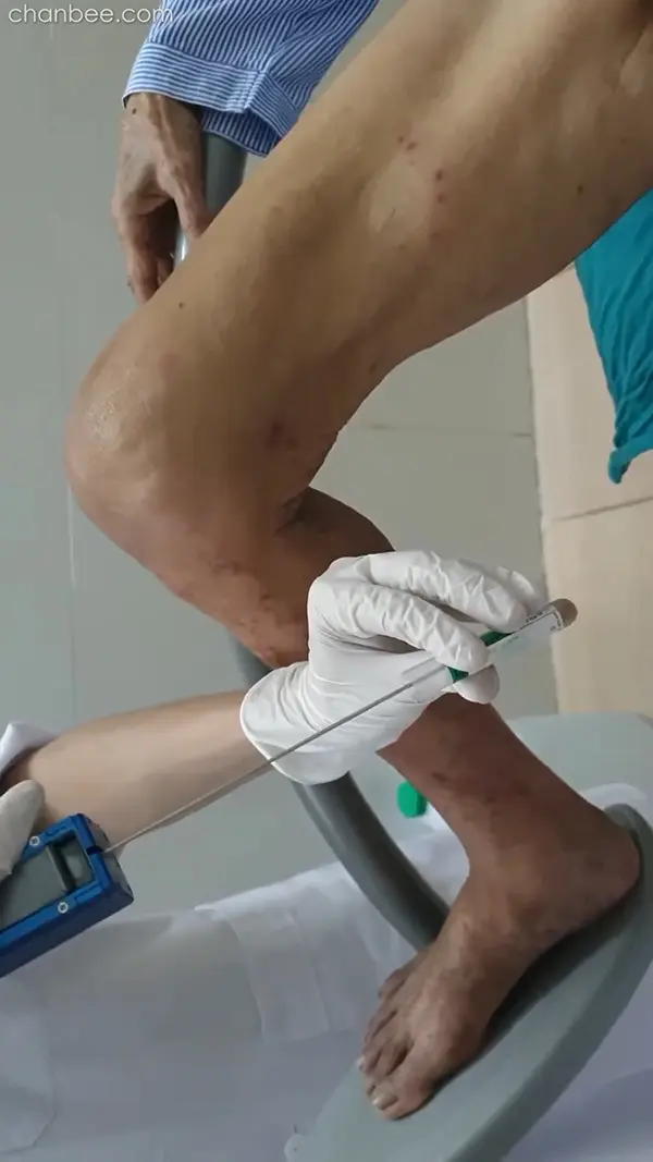 老年男性前列腺仪器检查-0001