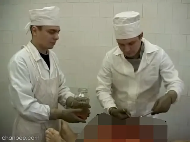 男性大体老师病理解刨-0011