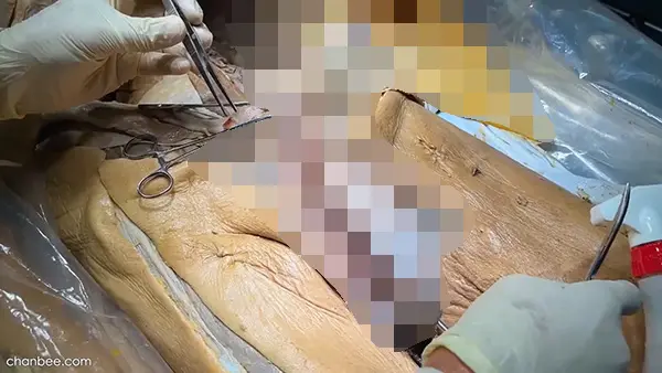 男性阴茎海绵体血管神经解刨讲解-0001