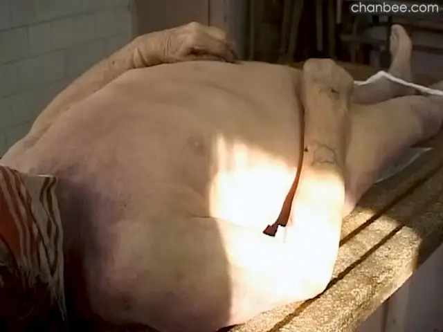 男性大体老师病理解刨-0008