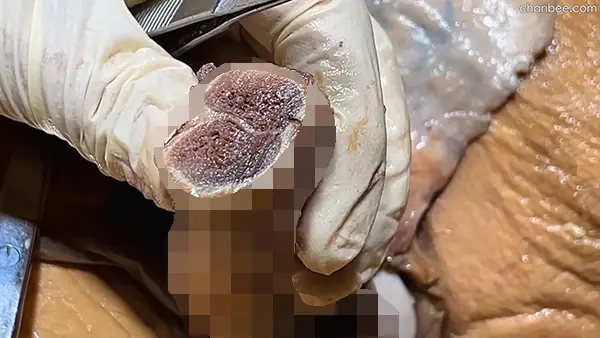 男性阴茎海绵体血管神经解刨讲解-0007