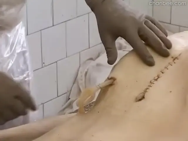 男性大体老师病理解刨-0009