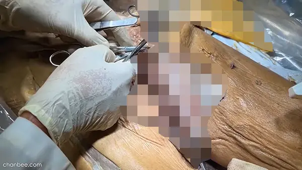 男性阴茎海绵体血管神经解刨讲解-0003