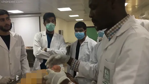 临床学生观摩导师用老年大体老师解刨讲解睾丸结构-0003