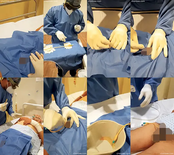 男护士学习给病床老年男性插导尿管-0002