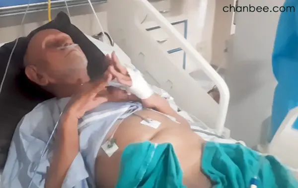 护士帮病床男性老年人把尿套改成导尿管