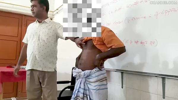导师给学员讲解男性疝气